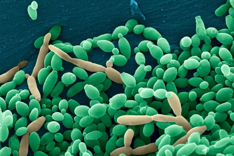 Candida tropicalis — распространенный грибковый патоген, который обнаруживается и в опухолях