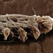 клещ Demodex